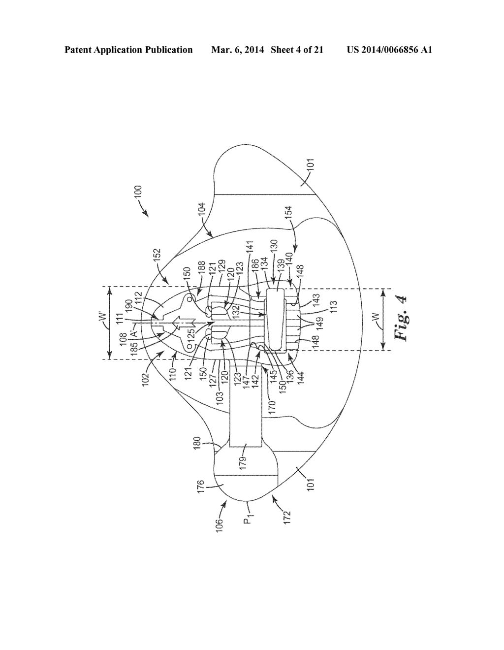 MEDICAL ARTICLE SECUREMENT SYSTEMS COMPRISING A BRACKET AND A FLAP - diagram, schematic, and image 05