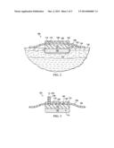 DRESSINGS AND METHODS FOR TREATING A TISSUE SITE ON A PATIENT diagram and image