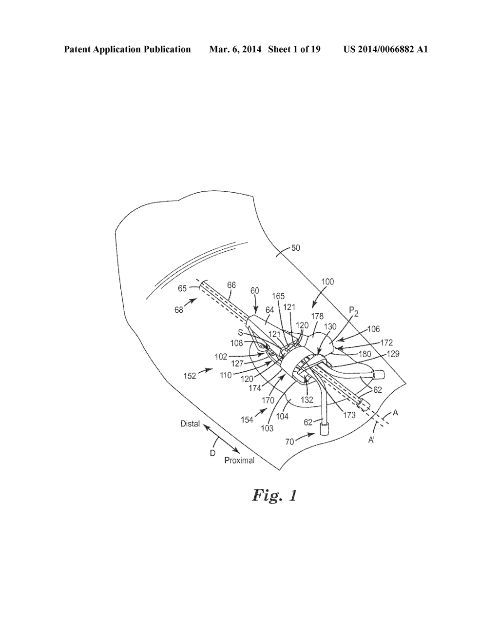 MEDICAL ARTICLE SECUREMENT SYSTEMS COMPRISING INDICIA AND METHODS OF USING     SAME - diagram, schematic, and image 02