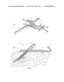 SAFEGUARDING MEASURES FOR A CLOSED-LOOP INSULIN INFUSION SYSTEM diagram and image