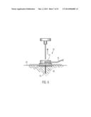 SAFEGUARDING MEASURES FOR A CLOSED-LOOP INSULIN INFUSION SYSTEM diagram and image