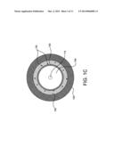 RETRACTABLE SHEATH DEVICES, SYSTEMS, AND METHODS diagram and image