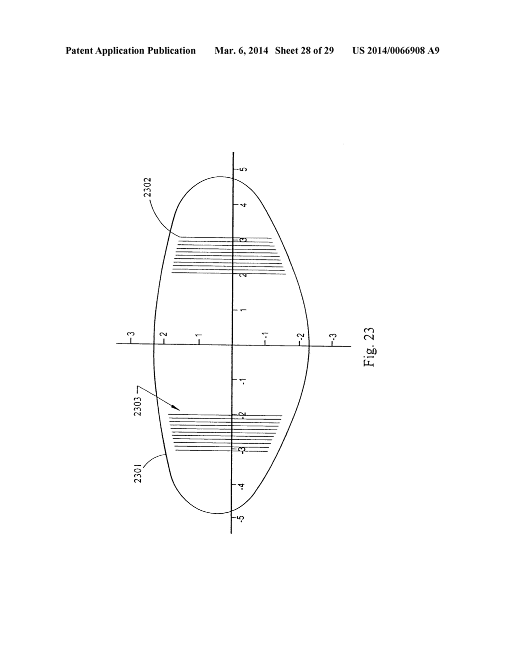 System and method for improving the accommodative amplitude and increasing     the refractive power of the human lens with a laser - diagram, schematic, and image 29