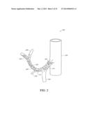 NEUROMODULATION METHODS USING BALLOON CATHETER diagram and image