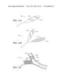 NEUROMODULATION METHODS USING BALLOON CATHETER diagram and image