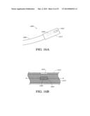 NEUROMODULATION METHODS USING BALLOON CATHETER diagram and image