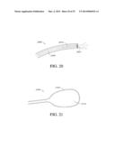 NEUROMODULATION METHODS USING BALLOON CATHETER diagram and image