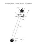 EXTERNAL FIXATION diagram and image