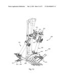 EXTERNAL FIXATION diagram and image