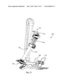 EXTERNAL FIXATION diagram and image