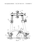 EXTERNAL FIXATION diagram and image