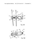 EXTERNAL FIXATION diagram and image