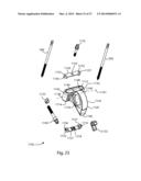 EXTERNAL FIXATION diagram and image