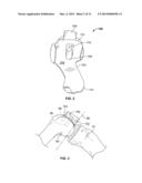 PATIENT-SPECIFIC PARTIAL KNEE GUIDES AND OTHER INSTRUMENTS diagram and image