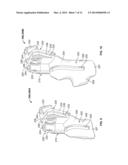 PATIENT-SPECIFIC PARTIAL KNEE GUIDES AND OTHER INSTRUMENTS diagram and image