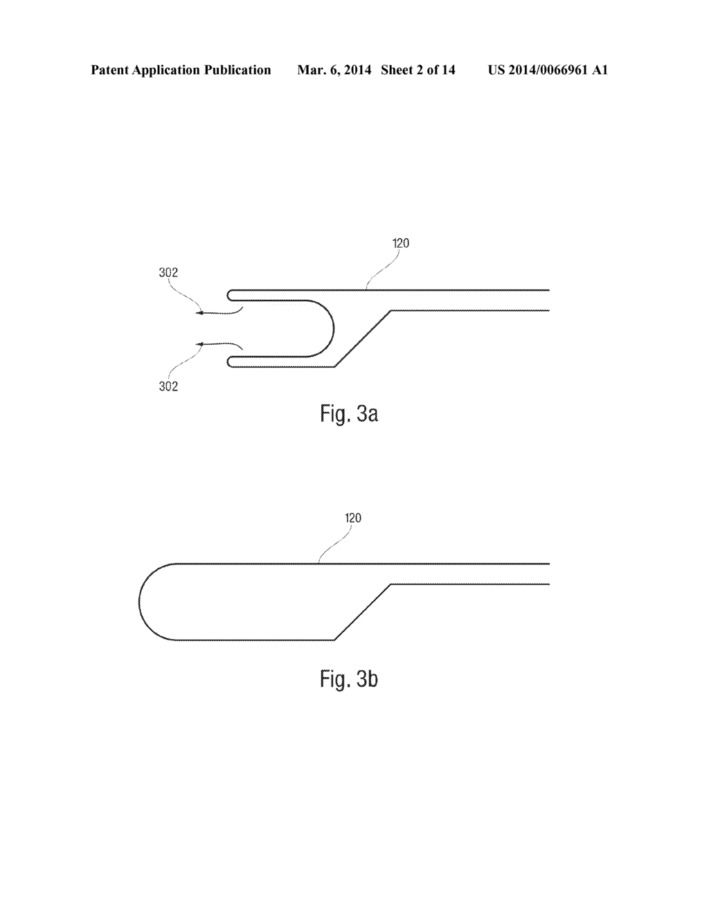 Catheter with Vessel Lining and Methods for Using Same - diagram, schematic, and image 03