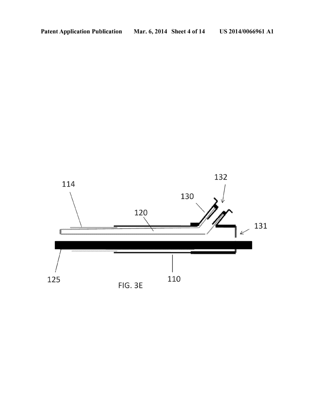 Catheter with Vessel Lining and Methods for Using Same - diagram, schematic, and image 05