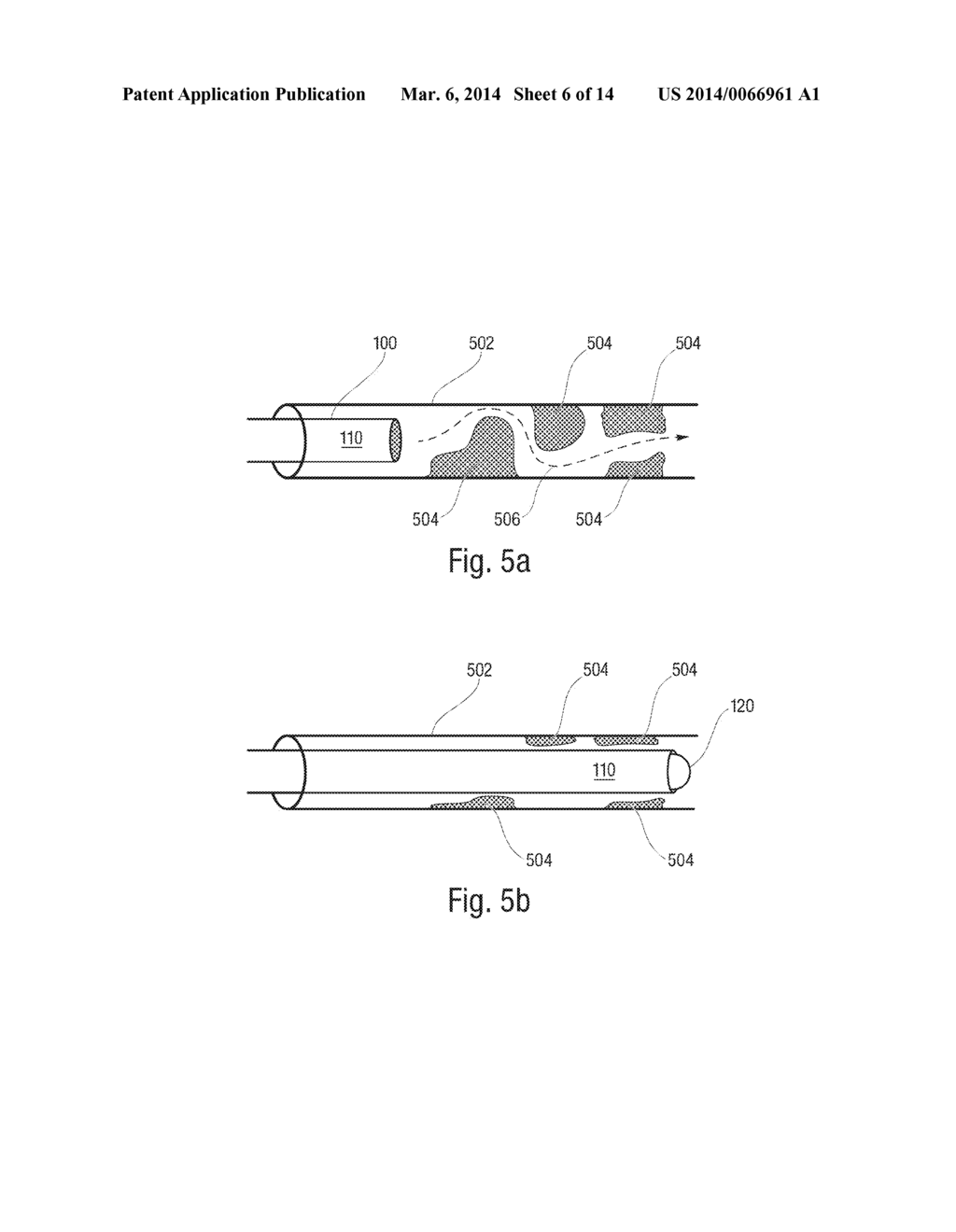 Catheter with Vessel Lining and Methods for Using Same - diagram, schematic, and image 07