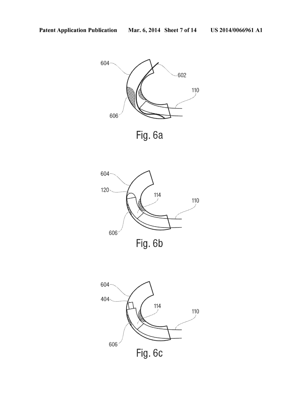 Catheter with Vessel Lining and Methods for Using Same - diagram, schematic, and image 08