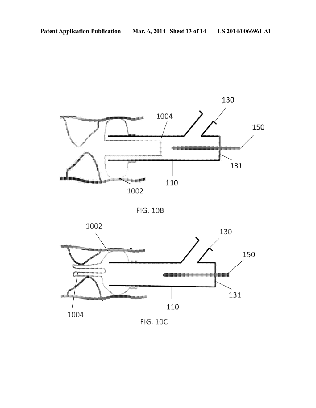 Catheter with Vessel Lining and Methods for Using Same - diagram, schematic, and image 14