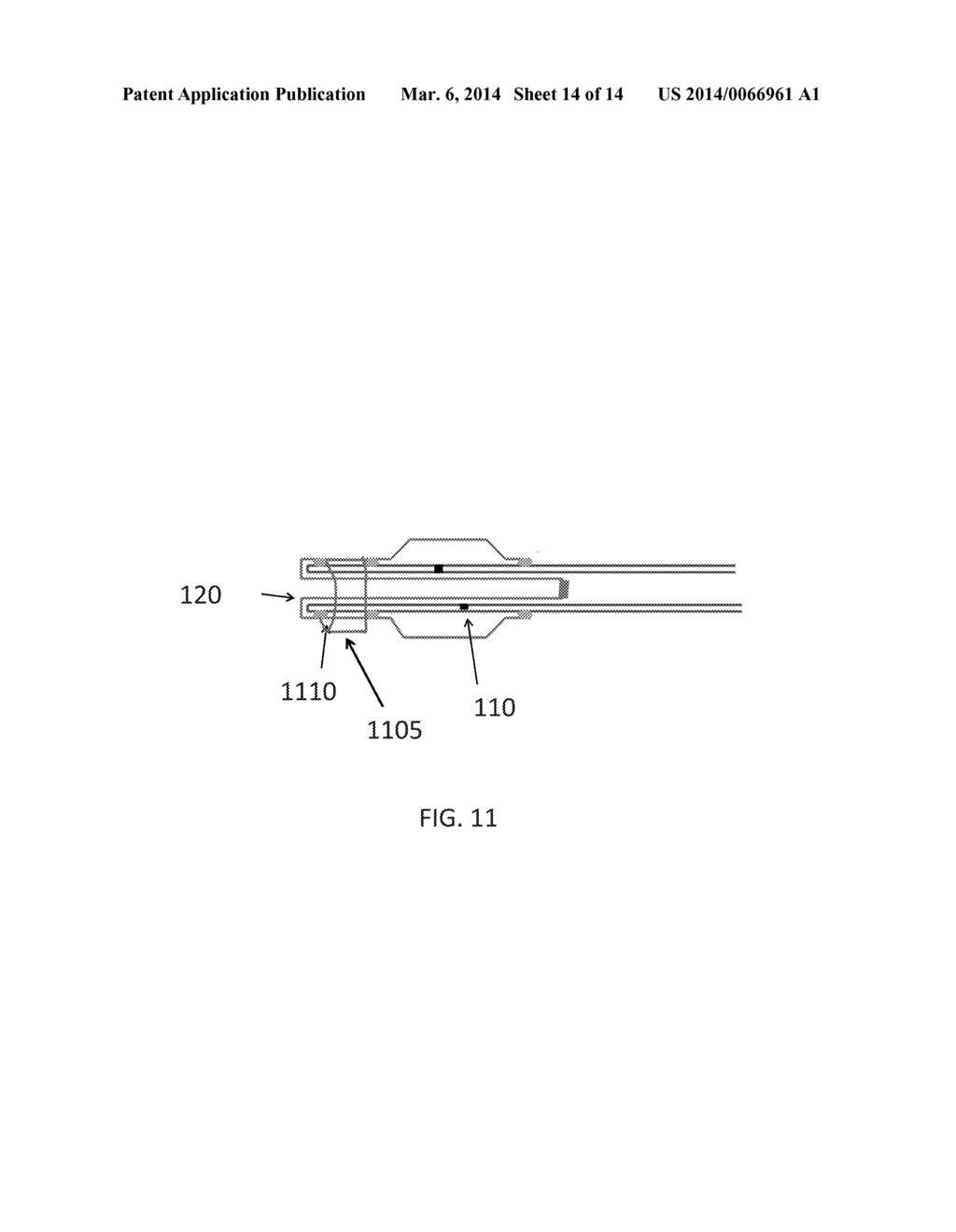 Catheter with Vessel Lining and Methods for Using Same - diagram, schematic, and image 15