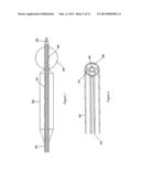 ENDOPYLORIC TOOL AND METHOD TO TREAT HYPERTROPIC PYLORIC STENOSIS diagram and image