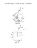 ANATOMICALLY ADAPTED INGESTIBLE DELIVERY SYSTEMS AND METHODS diagram and image