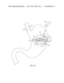 ANATOMICALLY ADAPTED INGESTIBLE DELIVERY SYSTEMS AND METHODS diagram and image