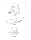 ANATOMICALLY ADAPTED INGESTIBLE DELIVERY SYSTEMS AND METHODS diagram and image