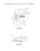 ANATOMICALLY ADAPTED INGESTIBLE DELIVERY SYSTEMS AND METHODS diagram and image