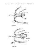 ANATOMICALLY ADAPTED INGESTIBLE DELIVERY SYSTEMS AND METHODS diagram and image