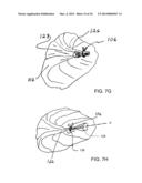 ANATOMICALLY ADAPTED INGESTIBLE DELIVERY SYSTEMS AND METHODS diagram and image