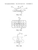 ANATOMICALLY ADAPTED INGESTIBLE DELIVERY SYSTEMS AND METHODS diagram and image