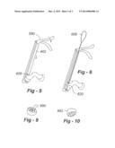 PERCUTANEOUS FACET FIXATION SYSTEM diagram and image