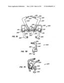 Adjacent Level Facet Arthroplasty Devices, Spine Stabilization Systems,     and Methods diagram and image