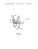 Adjacent Level Facet Arthroplasty Devices, Spine Stabilization Systems,     and Methods diagram and image