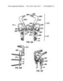 Adjacent Level Facet Arthroplasty Devices, Spine Stabilization Systems,     and Methods diagram and image