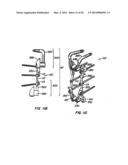 Adjacent Level Facet Arthroplasty Devices, Spine Stabilization Systems,     and Methods diagram and image