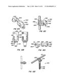 Adjacent Level Facet Arthroplasty Devices, Spine Stabilization Systems,     and Methods diagram and image