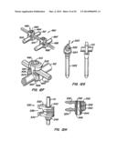 Adjacent Level Facet Arthroplasty Devices, Spine Stabilization Systems,     and Methods diagram and image