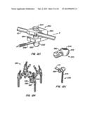 Adjacent Level Facet Arthroplasty Devices, Spine Stabilization Systems,     and Methods diagram and image