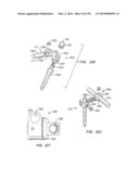 Adjacent Level Facet Arthroplasty Devices, Spine Stabilization Systems,     and Methods diagram and image