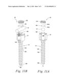 ADJUSTABLE BONE SCREW ASSEMBLY diagram and image