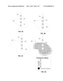 CAPTURE AND VISUALIZATION OF CLINICAL EFFECTS DATA IN RELATION TO A LEAD     AND/OR LOCUS OF STIMULATION diagram and image