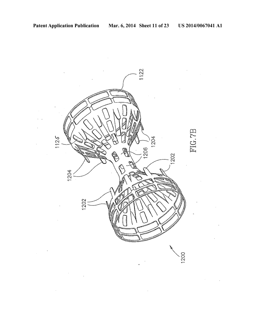 METHODS FOR TREATING ABNORMAL GROWTHS IN THE BODY USING A FLOW REDUCING     IMPLANT - diagram, schematic, and image 12