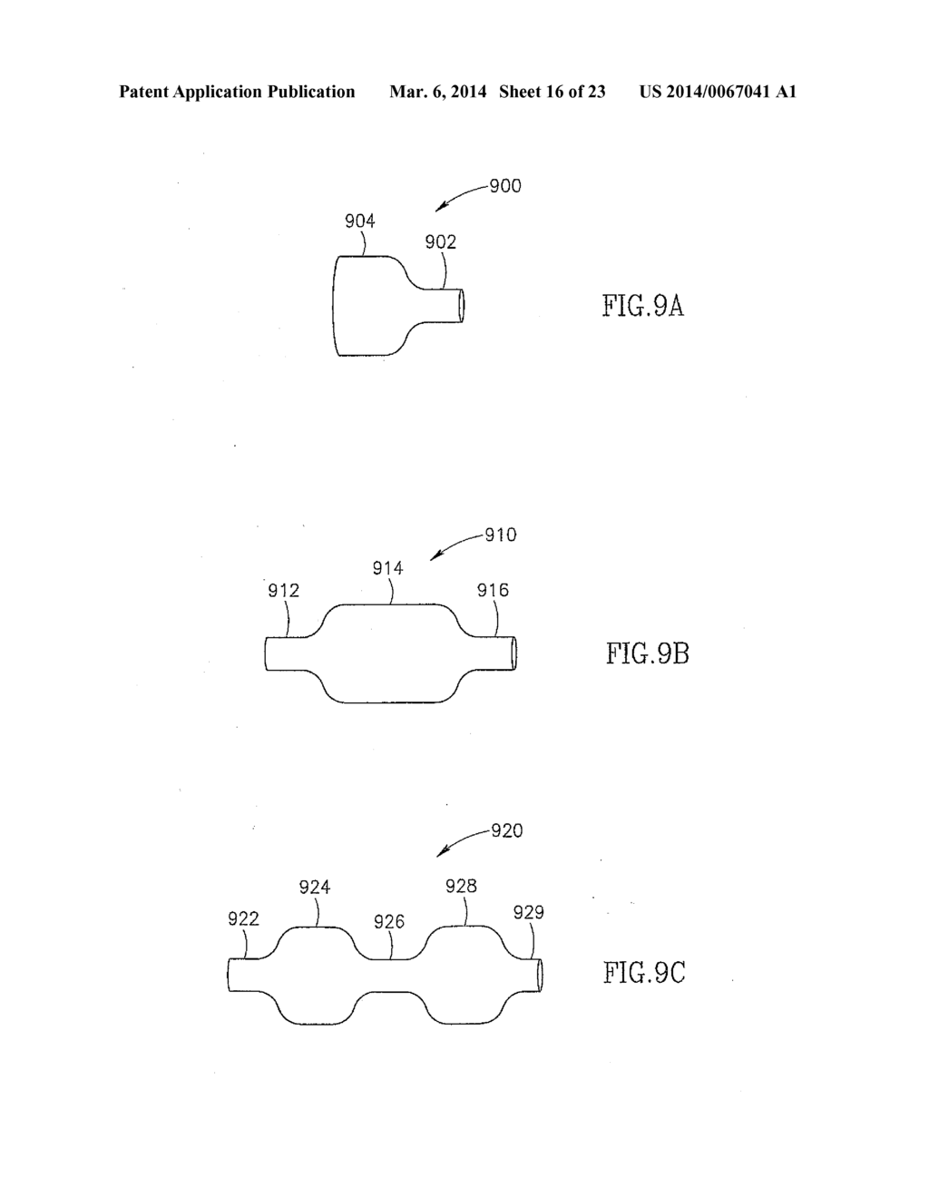 METHODS FOR TREATING ABNORMAL GROWTHS IN THE BODY USING A FLOW REDUCING     IMPLANT - diagram, schematic, and image 17