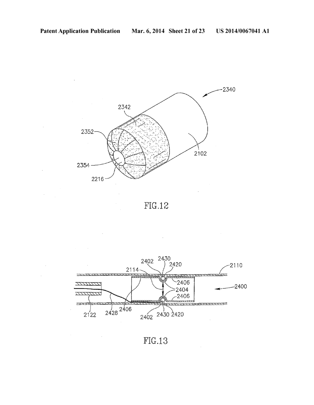 METHODS FOR TREATING ABNORMAL GROWTHS IN THE BODY USING A FLOW REDUCING     IMPLANT - diagram, schematic, and image 22