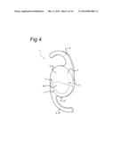 OPHTHALMIC LENS HAVING ENHANCED OPTICAL BLENDING ZONE diagram and image