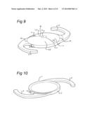 OPHTHALMIC LENS HAVING ENHANCED OPTICAL BLENDING ZONE diagram and image