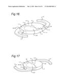 OPHTHALMIC LENS HAVING ENHANCED OPTICAL BLENDING ZONE diagram and image